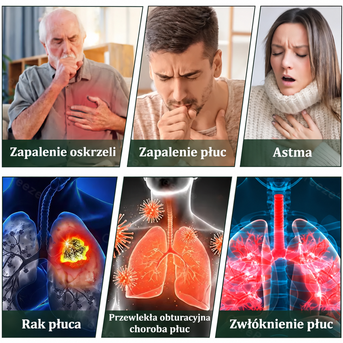 Wysokiej jakości polskie produkty z dostawą w całym kraju 🍎 Ziołowy inhalator 𝐋𝐮𝐦𝐨𝐫𝐢𝐞® wspiera komfort oddychania i pomaga łagodzić kaszel, ból gardła, duszność, nadmiar wydzieliny, zatkany nos oraz objawy alergii.