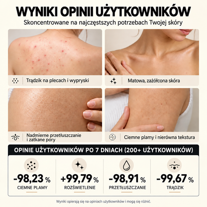 🥭Mydło z niacynamidem rozjaśniające skórę – na ostudę, ciemne plamy i piegi